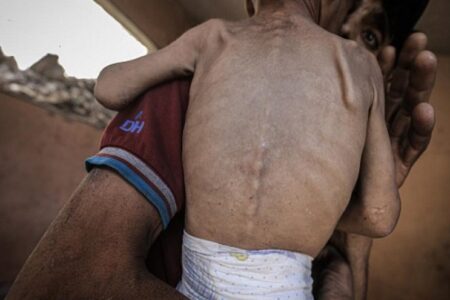 ۶۲۰ فلسطینی به خاطر گرسنگی و نبود دارو  جان باختند/ 69 نفر کودک هستند