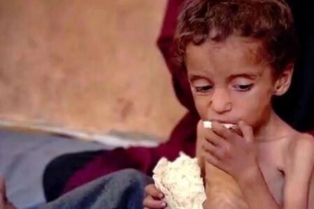 سوء تغذیه شدید ۴۰هزار کودک در نوار غزه/ تهدید زندگی معلولان