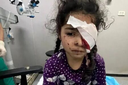 دنیای تیره و تار کودکان؛ 1700 نفر در غزه به دلیل آسیب‌های چشمی معلول شده‌اند