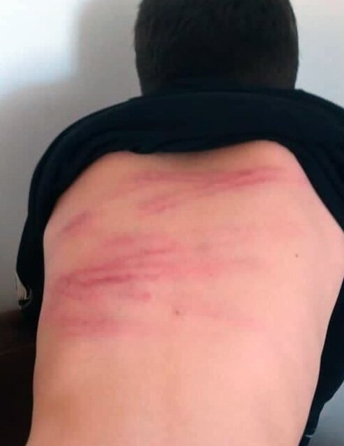 6213353-3 ضرب و شتم دانشآموزان با کابل توسط معلم/ عکس