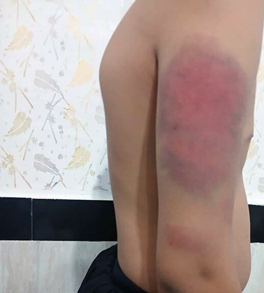 6213354-3 ضرب و شتم دانشآموزان با کابل توسط معلم/ عکس