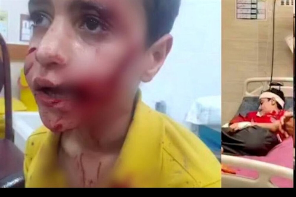 6291726 از امیرعلی تا مهسا؛ قربانیان فراموششده سگهای بیصاحب در ایران/ «شخصی با نفوذ قابل توجه از حامیان سگهای ولگرد است»/ مرگ ۱۸ کودک طی چهار سال